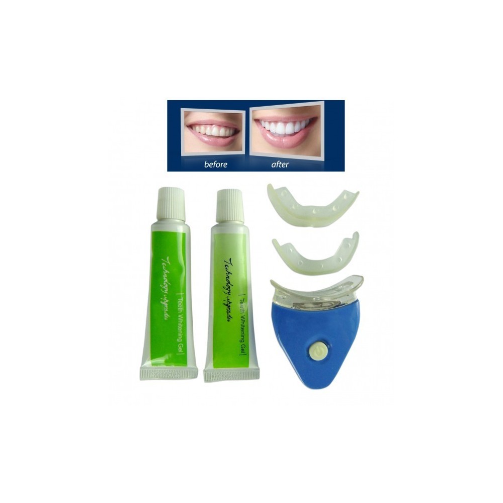 Kit de blanchiment des dents – Résultats dents blanches en 20 minutes