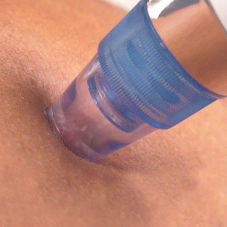 345636 Nettoyant visage SUCTION des pores boutons et impuretés