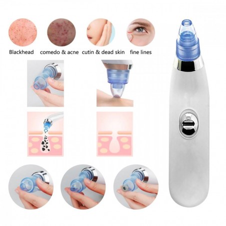 345636 Nettoyant visage SUCTION des pores boutons et impuretés